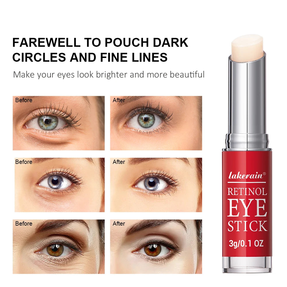Eye Cream Lightening Dark Circles