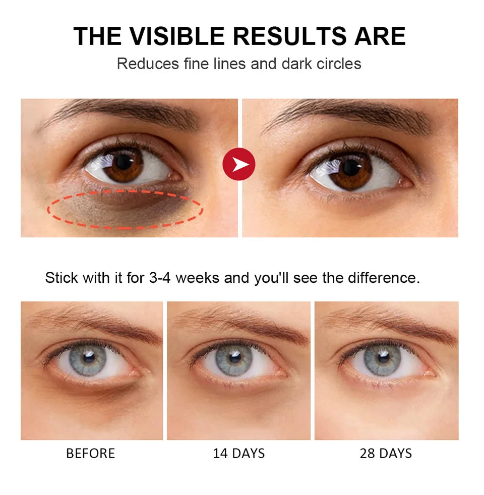 Eye Cream Lightening Dark Circles