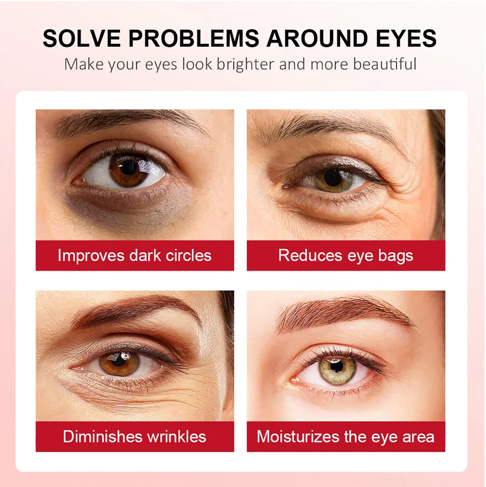 Eye Cream Lightening Dark Circles