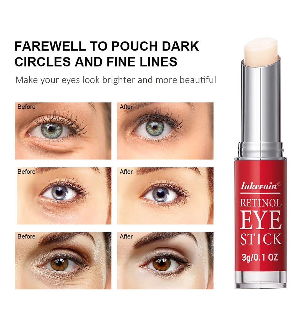 Eye Cream Lightening Dark Circles